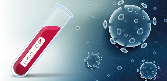 Corona Test Positive - Step By Step Guidance: What to Do Next Corona Test Positive - Step By Step Guidance: What to Do Next